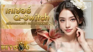 เลเซอร์ Q-Switch